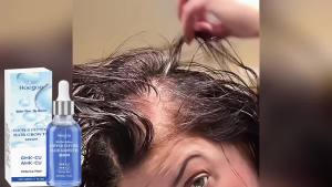 Huyết Thanh Dưỡng Tóc Copper Peptide GHK-Cu Chăm Sóc Hàng Ngày Giúp Tóc Dày Hơn Tăng Cường Da Đầu Kích Hoạt Nang Tóc Chống Gãy Rụng Dùng Được Cho Cả Nam Và Nữ 30ml