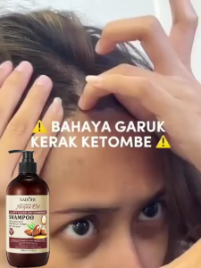 【COD ORI】SADOER shampoo rambut rontok dan ketombe shampoo 500ml anti ketombe Obat Ketombe Rambut Mencegah Berminyak Rambut Rontok Sampo Anti Tungau Gatal