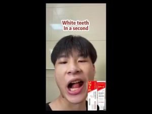 120g Pasta Gigi Probiotik SP-6 Whitening Toothpaste Pemutih Gigi Untuk Anak Dewasa Gigi Putih Gigi Kuning Penghilang Karang Membersihkan Gigi Kuning Bau Mulut Segar Cegah Kerusakan Gigi Anak Pembersih Karang Gigi