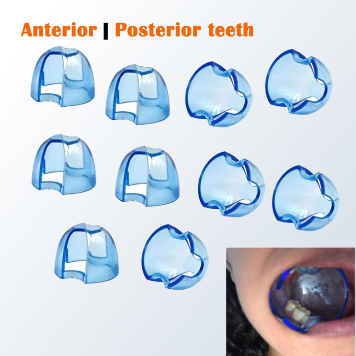 Dental Lip Expander & Cheek Retractor For Orthodontic Photography – Side View Mouth Opener Tool