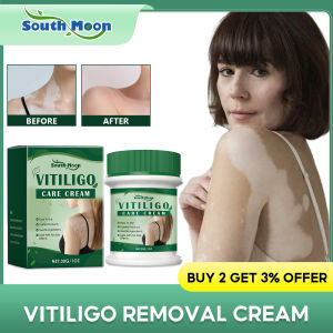 South Moon | ﻿White Spots Removal Cream Repair Skin Vitiligo Enhance Melanin Even Skin Tone Prevent Spread Leukoplakia Treatment Ointment
