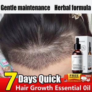 Penumbuh rambut cepat rambut serum penumbuh 60ml obat penumbuh rambut penumbuh rambut botak Ekstrak herbal Serum Penumbuh Rambut Kebotakan Nutrisi Dalam