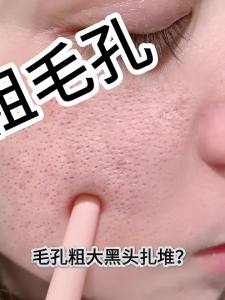 FANGXIANG | Blackhead Remover Pore Minimizer Deep Cleansing Nose Mask