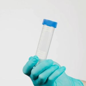 100Pcs 15ML Centrifuge Tube Conical Bottom Laboratory Centrifuge Tube With Lid