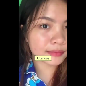 SADOER Repair Acne Cream Anti Acne Spots Acne Treatment Scar Blackhead Cream Shrink Pores Whitening Moisturizing Face Skin Care 50g