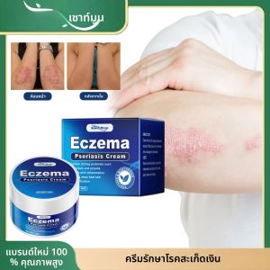 กลากโรคสะเก็ดเงินครีมบรรเทาสีแดงบวม Anti-Inflammatory เหมาะสําหรับปัญหาผิวต่างๆสมุนไพร Antipruritic Ointment
