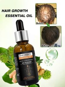Hair Growth Shampoo 250ml / Essential Oil 30ml Anti-Hair Loss Reduce Hair Fall Oily Scalp Strengthen Hair Root