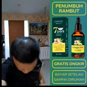Penumbuh Botak Dan Rontok (HANYA 7 HARI) Pria Anak Bayi Balita Cepat Serum Essence Penghitam Uban Penyubur / 7 Days