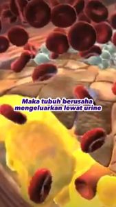 CUKAKAMU ekstrak kurma alami untuk obat diabetes dan menurunkan gula darah - 1 Botol