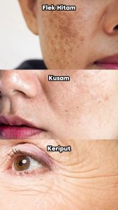 PHARMASKIN SOLUTION Paket Whitening Flek Hitam