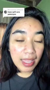 Winland 100% ORI Alat Penyedot komedo Vaccum Microcrystalline Remove Blackhead instrument Versi yang ditingkatkan