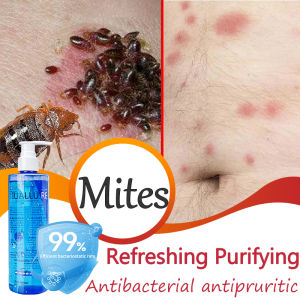 Antibacterial Body Wash anti-acne body wash Refreshing Shower and Bath Gel 300ml Acne Foaming Wash Deodorize & Purify Refreshing and Purifying Deodorize & Exfoliating help soothe itchy dry skin Back Mite Removal Anti-bacterial Deep Cleaning