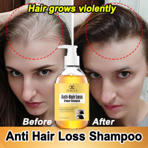 LYDIMOON Anti Hair Loss Shampoo 300ML Ginger Shampoo Hair Growth Shampoo Stabilises Hair Roots Promotes Hair Growth Increases Hair Volume 洗发水防脱发