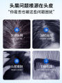Seborrheic Dermatitis Shampoo for Teens And Kids Men And Women Dandruff Control Anti-Itch Oil Control Amino Acid Formula. 