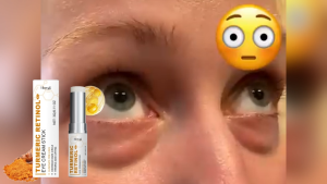 Retinol Eye Cream: Instantly Eliminates Eye Bags Combats Milia Fades Dark Circles Reduces Puffiness Minimizes Fine Lines Lifts Brightens.