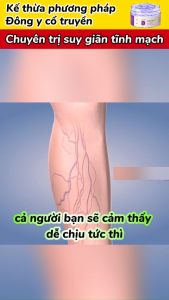 Kreain Gel Tím Cải Thiện Giãn Tĩnh Mạch Đau Và Sưng Dưới Chân Tĩnh Mạch Nổi Chuột Rút Tê Mỏi Chân Giun