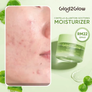 Glad2Glow Centella Asiatica Soothing Gel Moisturizer Allantoin Oat Extract Acne Redness Control Facial Gel for Oily Acne Prone Sensitive Skin 55g