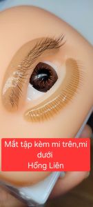 Con mắt tập nối có mi trên mi dưới