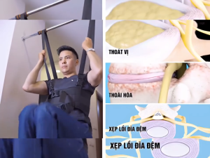 [HCM] Đai treo kéo giãn cột sống lưng - Hỗ trợ giãn đĩa đệm giảm đau lưng đùi chân hiệu quả