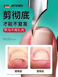 Dụng Cụ Cắt Móng Chân Dành Cho Móng Mọc Vào Trong Thiết Kế Nghiêng Dài