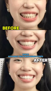 【Buy 1 Take 2】Japanese Colgate Whitening Toothpaste Peppermint Food Graded Soda Toothpaste