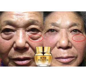 GOLD CAVIAR REPAIR EYECREAM Krim mata hilangkan eyebag gelap bawah mata bj kolestrol