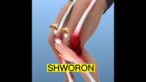 Bee Venom Gel & Joint Pain Relief: A Comprehensive Guide