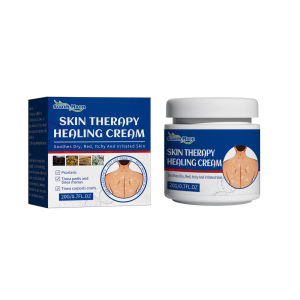 South Moon Skin Therapy Healing Cream Skin Antipruritic Cream Itch Relief Dermatitis Eczema Fungal Tinea Repair Cream Moisturizing Herbal Treatment Cream Psoriasis Antibacterial Cream Dermatitis Eczematoid Ointment Effective Anti-Itch Chinese Herb Medical - Lazada