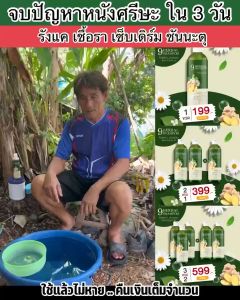 2แถม1 แชมพูสมุนไพรขุนเดช รังแค เชื้อราบนศรีษะ หนังศรีษะลอก มีรังแค หนังศรีษะแห้ง คัน ชันตุ กลากเกลื้อน คันหนังศรีษะ สิวบนหนังศรีษะ