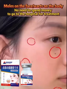 Mole Removal Wart Remover Skin Tag Remover Cream Antibacterial Potent Mole and Wart 5g