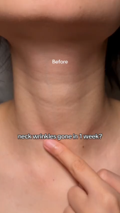 LYDIMOON Anti-wrinkle neck cream Neck mask 110g wrinkles firming neck lifting anti aging fine lines nicotinamide brightening