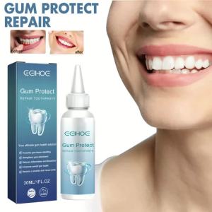 1 Chiếc Gel Bảo Vệ Nướu Sửa Chữa Làm Trắng Răng Bút Chăm Sóc Sức Khỏe Răng Miệng Toàn Diện Loại Bỏ Vết Bẩn Cao Răng Cho Răng Nhạy Cảm & Nướu Chảy Máu