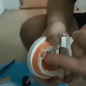 [Buy One Get Two Free] Denture Filling Gel Temporary Dental Restoration Temporary Resin Dentures Moldable Dentures Thermoforming Denture Solid Gel For Repairing Teeth And Gaps Solid Glue 30ml