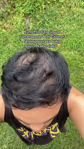 【BUY 1 TAKE 1 】KORMESIC 5% Minoxidil with Biotin Shampoo Conditioner Strengthening Hair Improve Dry & Reduce Hair Loss KORMESIC Likas na Solusyon sa Pagbawi ng Buhok