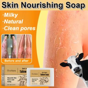 Tallow Soap Oil Control Exfoliation Deep Cleaner Anti-Acne Blackheads Remove Skin Oil Soap