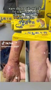 Kem bôi nấm ngứa kem bôi nẻ hổ vàng kem bôi da vảy nến hắc lào thành phần thảo mộc thiên nhiên - Happy Home 4U