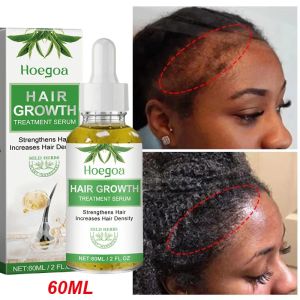 Fast Hair Growth Oil Rosemary Africa Crazy Traction Alopecia Serum Anti Hair Break Thicken Hair Loss Essential Oil For Man Women