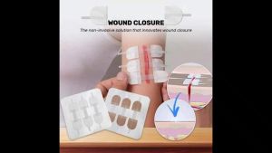 2Pcs Zipper Tie Wound Closure Patch Hemostatic Patch Wound Fast Suture Zipper Band-Aid Outdoor Portable