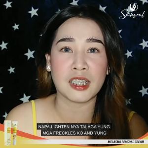 Skinsoul Melasma Cream Pekas Remover Pekas Cream Original