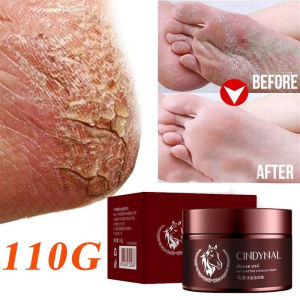 A.one 110g Horse Oil Foot Cream for Cracks and Dry Cracked Heel Cream Foot Care Crack Heel Callus Remover