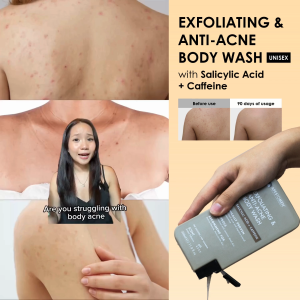 Apestomen Exfoliating & Anti-Acne Body Wash 350ml With Salicylic Acid | Clinically Proven To Treat Back Acne & Improve Overall Skin Appearance Controls Breakout & Remove Deadskin | pH 4.5-5.5 | Paraben Sulfate & Silicon free