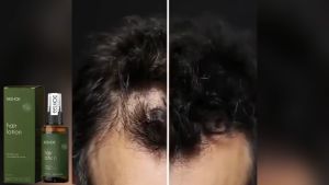 EELHOE Grapefruit Hair Growth Spray: Solusi Penumbuh Rambut Botak & Penebalan Rambut 100ML