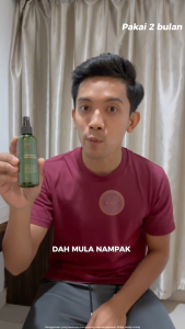 pelebat rambut hair tonic 100 herb for hair growth anti hair loss spay 100ml / serum pelebat rambut lelaki 2024