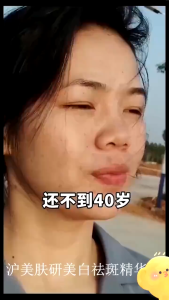 Nicotinamide Whitening Serum Untuk Flek Hitam Penghilang Flek Hitam Di Wajah Serum Wajah Glowing Dan Putih Melasma Flek Membandel Serum Melasma Freckles Remove Dark Spots