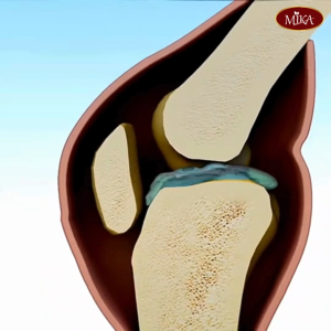 (สินค้าขายดี) MIKA - น้ำมันงาดำสกัดเย็น ผสมคอลลาเจน เซซามินเข้มข้น 3 เท่า - สถานีชาเย็น