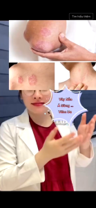 Kem Bôi Da Liễu Thảo Dược Cổ Truyền Senjoko Nhật Bản 50g - Kem Senjoko Giảm Ngứa Vẩy Nến Á Sừng Hắc Lào Tổ Đĩa