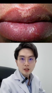 Serum Làm Hồng Môi Dưỡng Môi Làm Đầy Rãnh Môi Giảm Khô Môi SAUVASINE 10ml - Nuôi Dưỡng Tái Tạo Da Môi Ngăn Chặn Hình Thành Hạt Fordyce Làm Mềm Và Làm Mịn Các Đường Viền Môi Phục Hồi Và Dưỡng Ẩm Đôi Môi Đôi Môi Mềm Mịn Căng Bóng Quyến Rũ | Moska