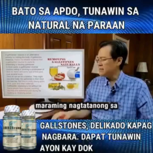 InnerCure l Original Gallbladder and Liver Support | Inner Cure for Gallstones | FDA Approved | 1 Bottle - 100 Soft gels