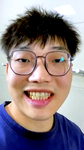 PASTA GIGI PEMUTIH GIGI KUNING PENGHANCUR KARANG GIGI