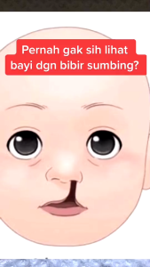 Botol Pipet Susu Bayi Asi Pigeon